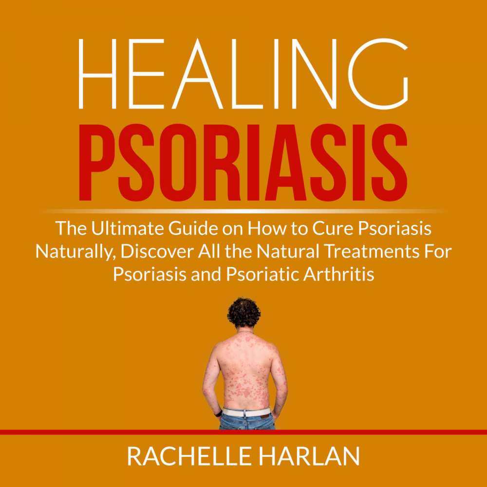 Cover von Rachelle Harlan - Healing Psoriasis - The Ultimate Guide on How to Cure Psoriasis Naturally, Discover All the Natural Treatments For Psoriasis and Psoriatic Arthritis